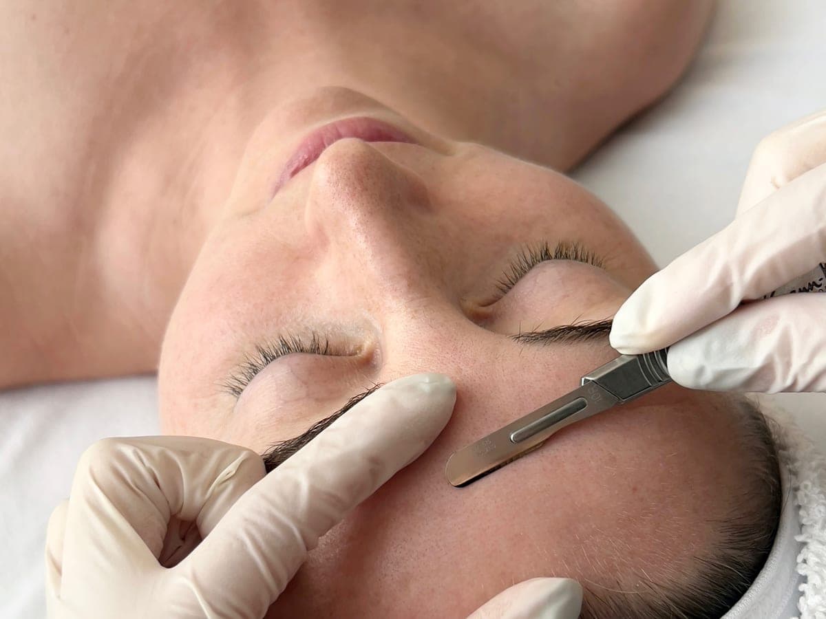 A gloved esthetician holding a dermaplaning blade flat against a reclining client's cheek