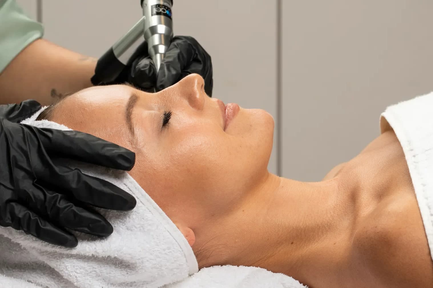 A ProCell microchanneling pen passing over a reclining client's forehead