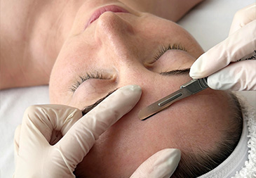 dermaplaning